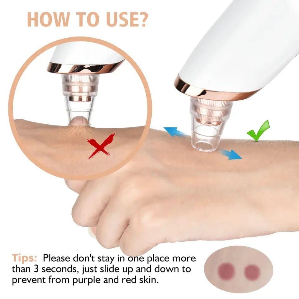 Product Name*: Battery Operated Black Head Remover.